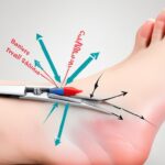 Olejek herbaciany na paznokcie – jak stosować dla najlepszych efektów?