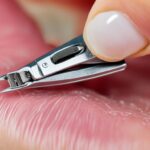 Grzybica paznokcia – najlepsze metody leczenia