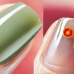 Jak wygląda schodzący paznokieć?