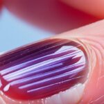 Jak Leczyć Paznokieć po Uderzeniu – Przewodnik